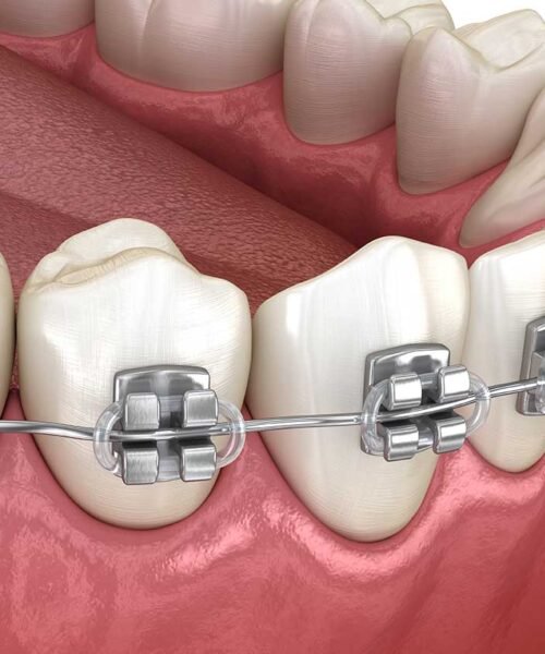 best-orthodontist-near-me-london