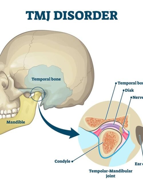 TMJ Treatment (Temporomandibular Joint Disorder) – Treats jaw pain and dysfunction.